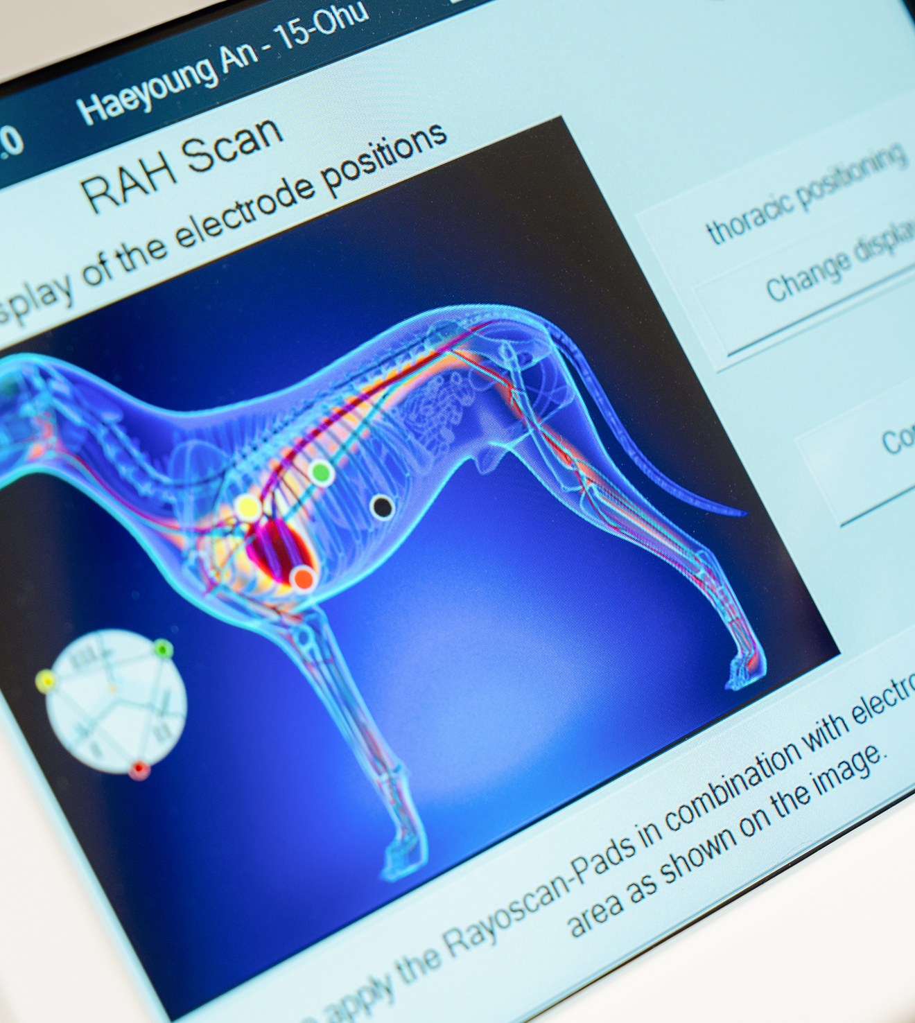 치료법 관련 이미지
